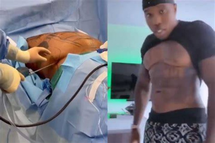 Bandman Kevo Before Surgery