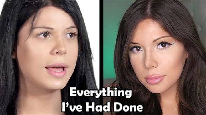 Blaire White Before And After Photos Plastic Surgery 2023