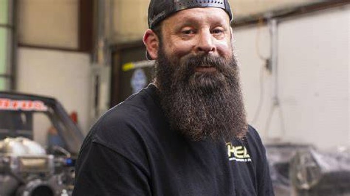 Patient Story Lyle Burn and Reconstructive Centers of America