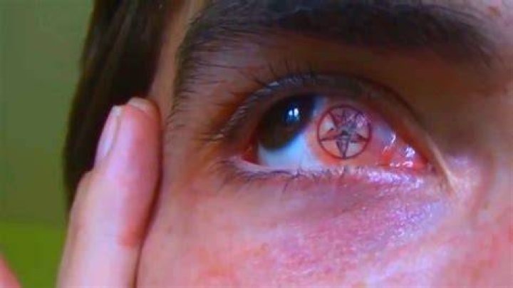 Source: YouTube (Eyeball tattooing)